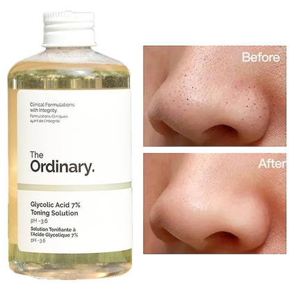 The Ordinary - Glycolic Acid 7% Toning Solution